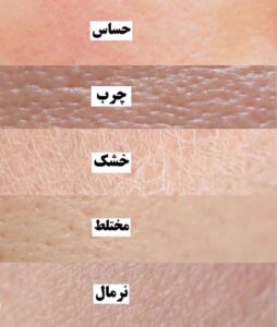 تشخیص نوع پوست و انواع آن 3 skin type shape